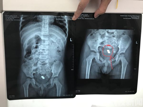 三岁男童不蹲着大便怎么办,3岁男宝宝不会去拉屎怎么办