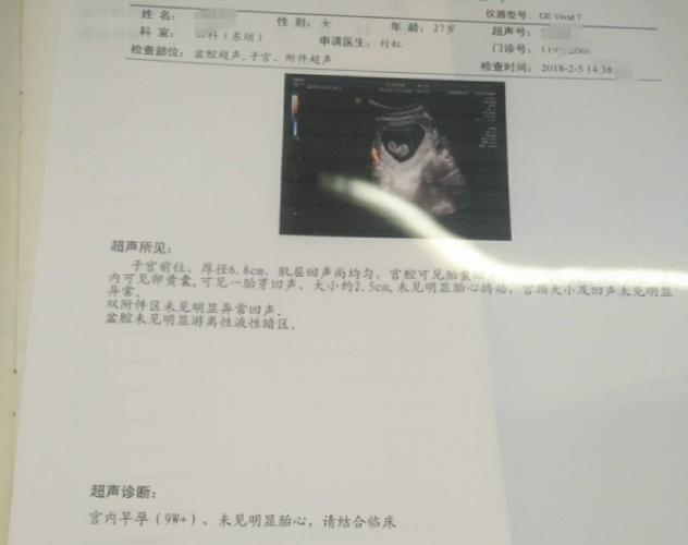 怀孕10周没胎心基本就胎停了,都怀孕十周了为什么反应还不消失