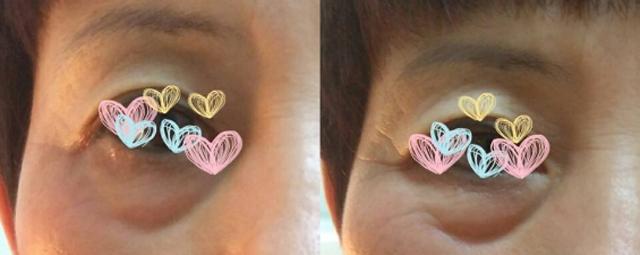 黑眼圈眼纹眼袋是怎么来的,黑眼圈眼袋眼纹问题