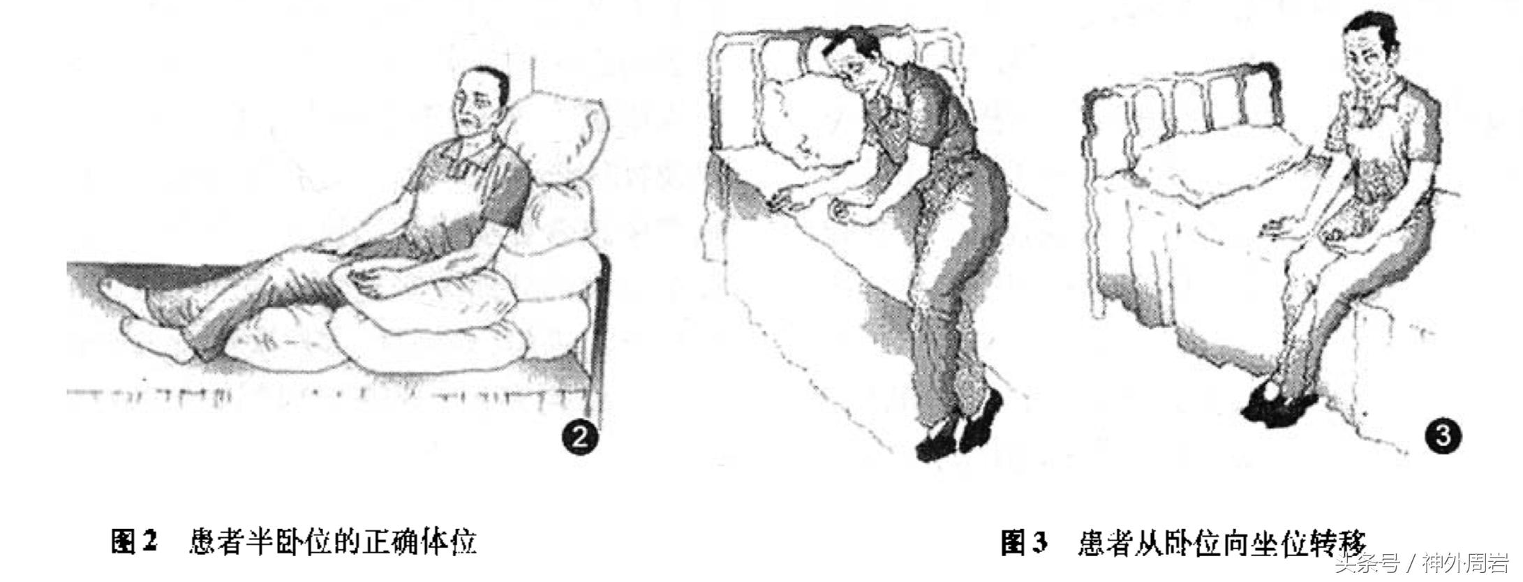 脑卒中康复治疗包括哪些,脑卒中康复训练需要做哪些