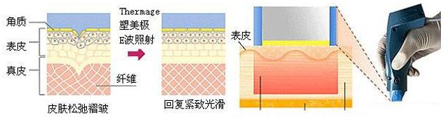 黑眼圈眼纹眼袋是怎么来的,黑眼圈眼袋眼纹问题