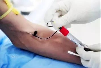 输液针口处淤青发红怎么回事,抽血后针口处淤青正常吗