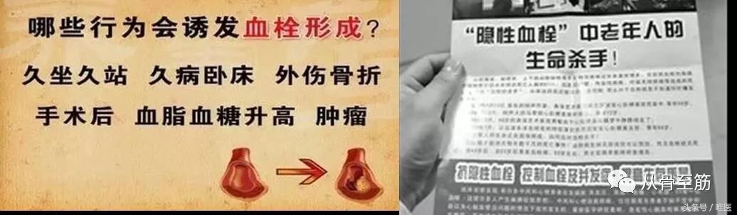 小血栓如何治疗,提前发现血栓小妙招