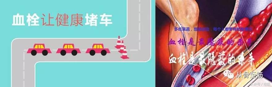 小血栓如何治疗,提前发现血栓小妙招