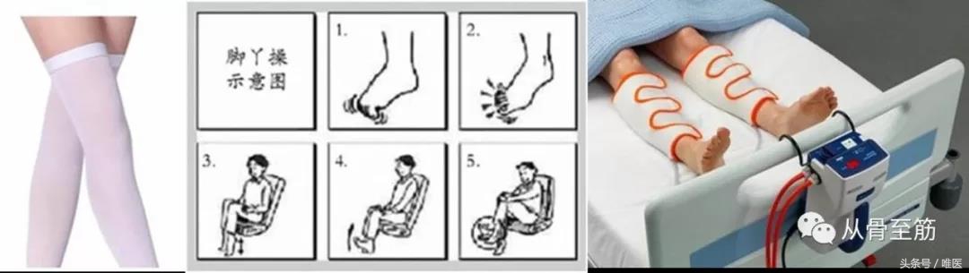 小血栓如何治疗,提前发现血栓小妙招