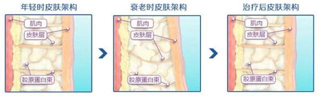 黑眼圈眼纹眼袋是怎么来的,黑眼圈眼袋眼纹问题