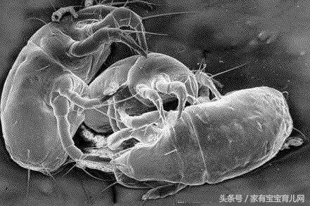 宝宝肚子里有蛔虫怎么视察,怎么预防宝宝肚子里有蛔虫