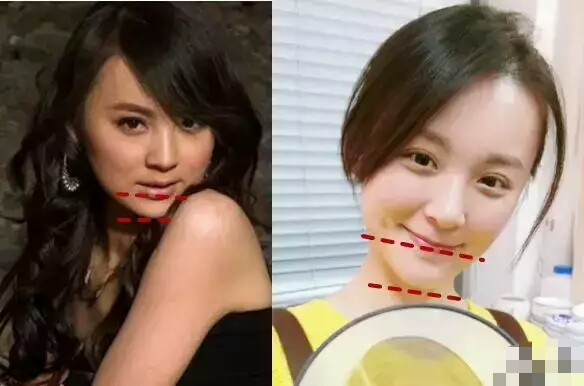 杨幂把自己的整形医生介绍给了闺蜜吗？如何越整越自然