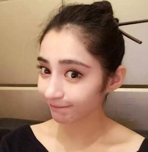 杨幂把自己的整形医生介绍给了闺蜜吗？如何越整越自然