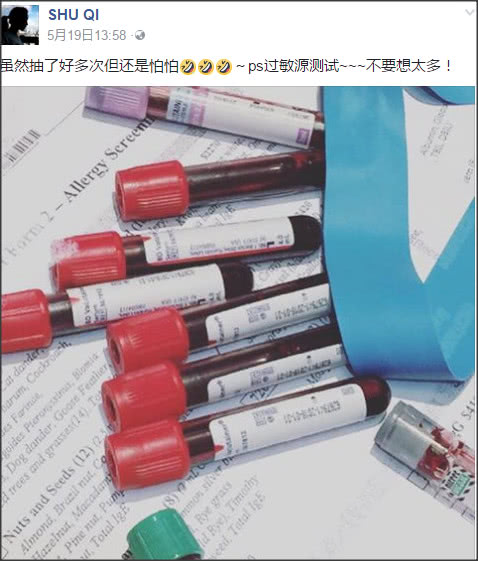 舒淇过敏都用什么护肤品呢,紫外线过敏舒淇