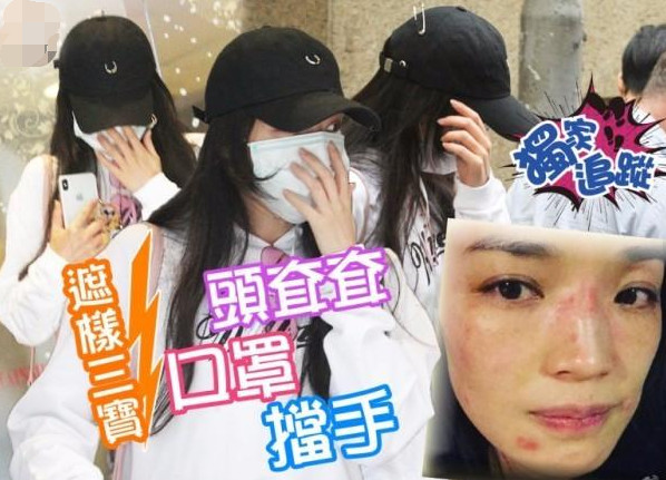 舒淇过敏都用什么护肤品呢,紫外线过敏舒淇