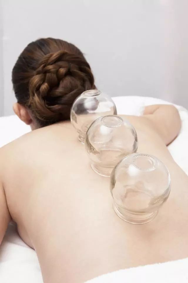 火罐拔哪些穴位可以减肥,每天火罐减肥的方法