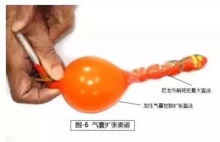 术后腹壁窦道怎样处理,腹部窦道手术怎么判断切除干净