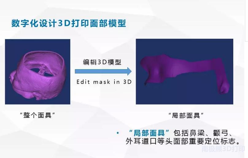 3D打印在脑出血治疗中的应用