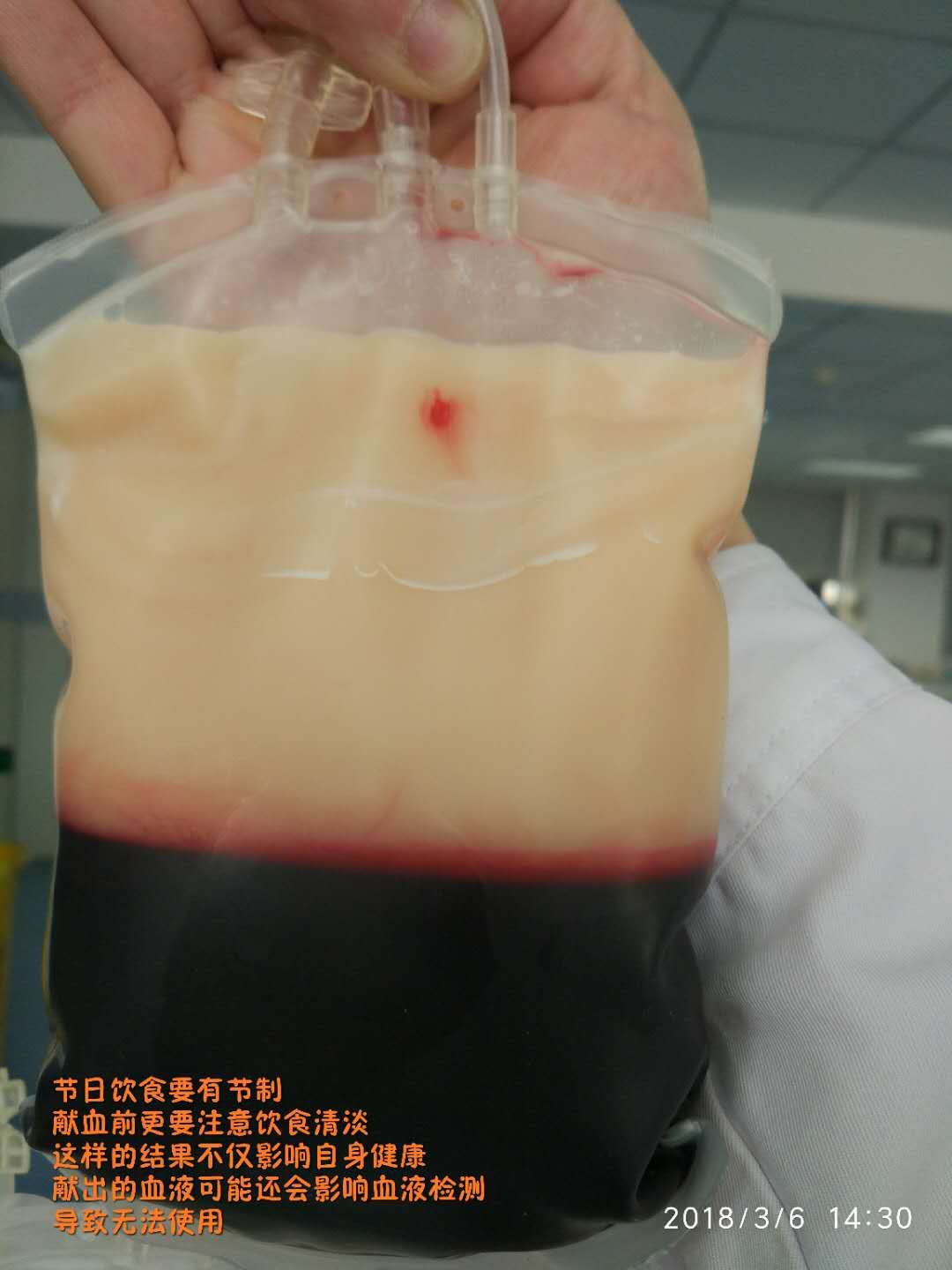 献血前能吃什么食物,为什么献血前不能吃花生