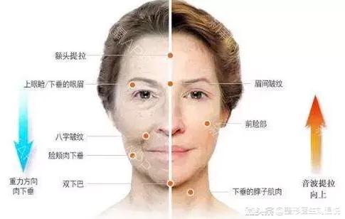 微整形要关注些什么,微整形要关注什么