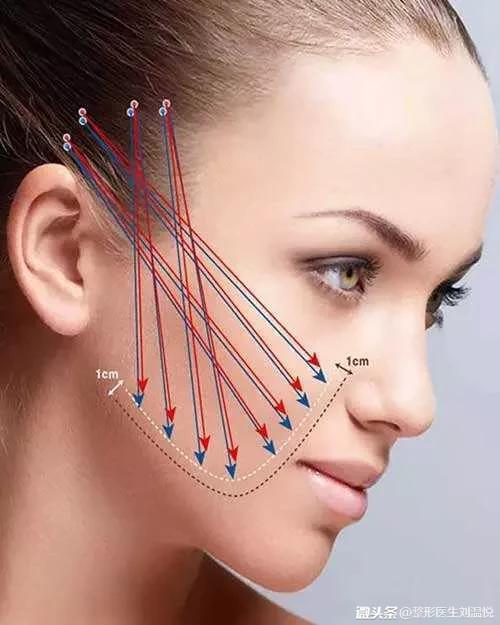 微整形要关注些什么,微整形要关注什么