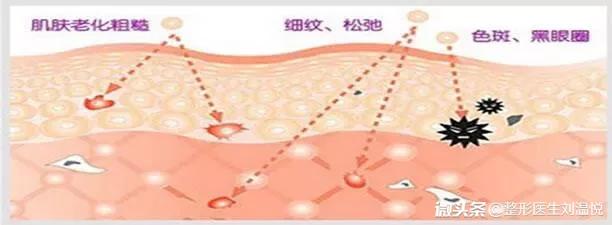 微整形要关注些什么,微整形要关注什么