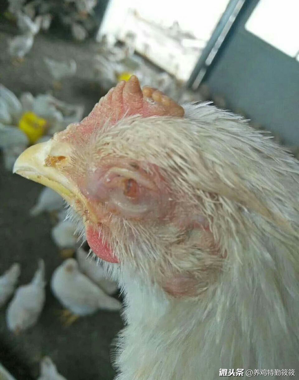 鸡眼肿用什么药膏,鸡眼是什么病怎样预防