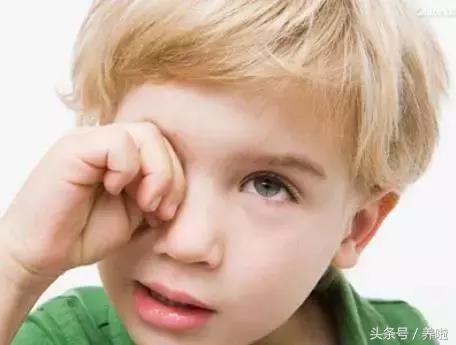 倒睫小宝宝,倒睫宝宝会怎么样