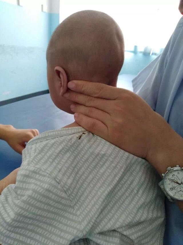 小儿推拿斜颈穴位有哪些,小儿斜颈推拿视频教程