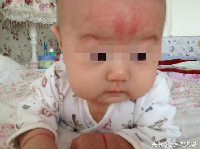 5岁小孩睡觉从床上摔下来,睡觉从床上摔下来