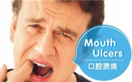 口腔溃疡最好的特效药,治疗口腔溃疡的药物粉末