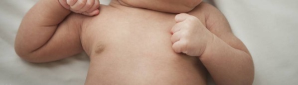 桶状胸手术,先天性桶状胸