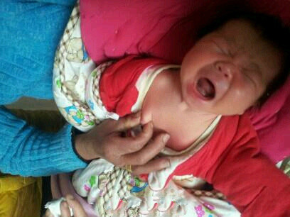 春节急诊，新生儿乳头红肿发炎！刚出生宝宝的乳头到底该不该挤？