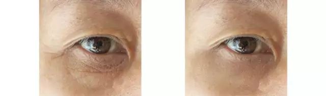 如何判断自己的眼睛的年龄,听说从一个人的眼睛可以看出年龄