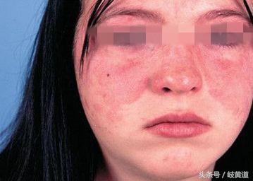 女子减肥造成身体虚弱喝什么药,女生减肥减出病