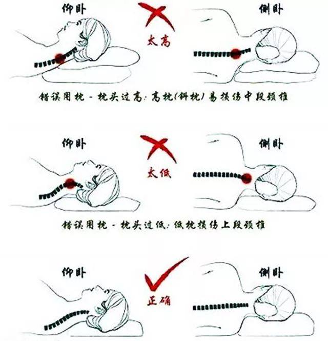 颈椎病引起头疼头晕中成药,颈椎病引起头晕恶心怎么办