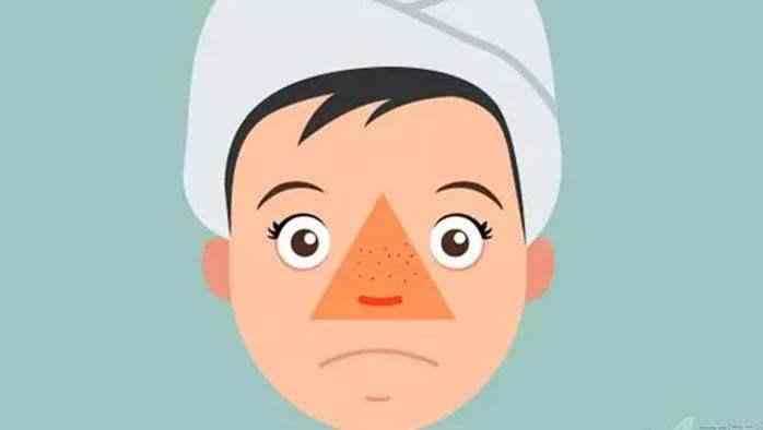 三角区毛孔粗大解决方法,三角区有粉刺毛孔粗大怎么办