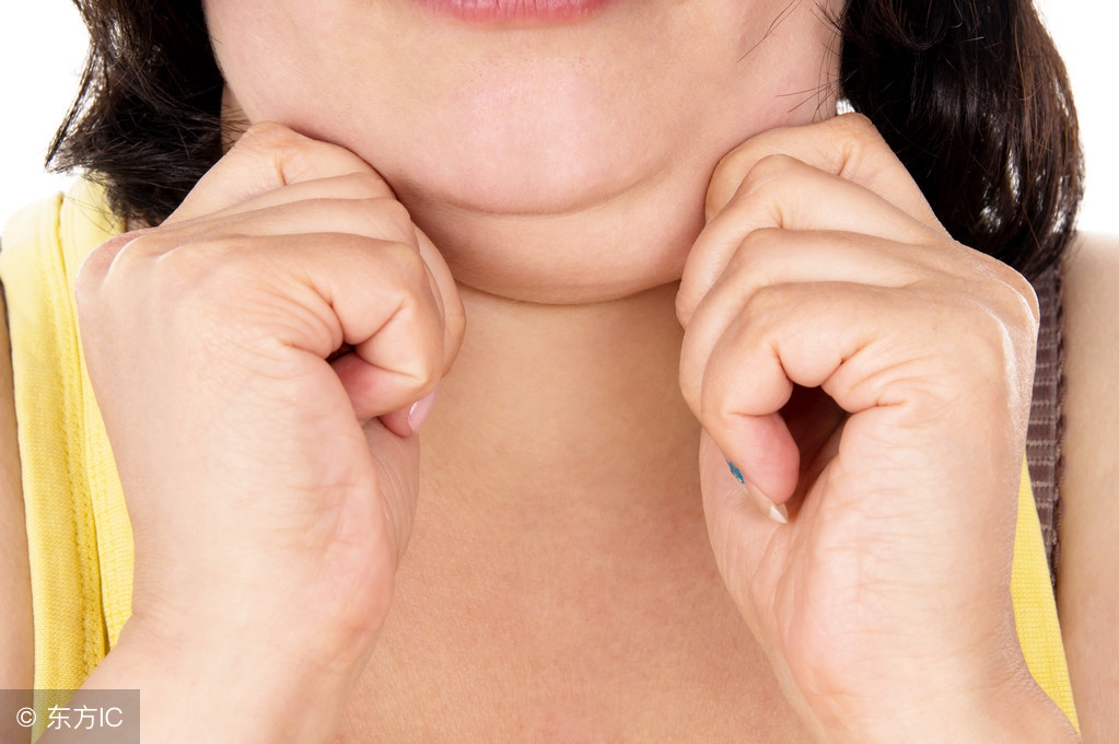 有双下巴怎么办才能瘦掉,有什么方法可以去除双下巴