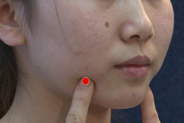 有双下巴怎么办才能瘦掉,有什么方法可以去除双下巴