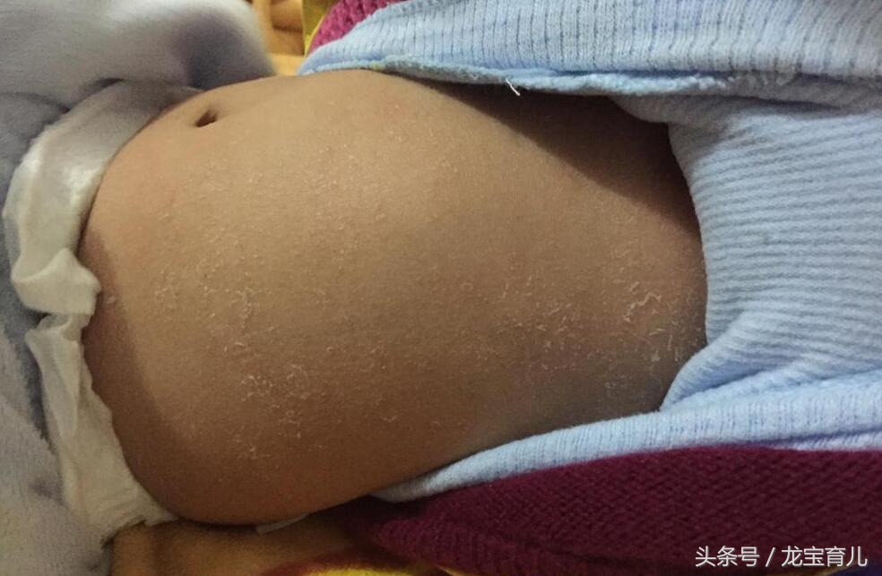 为什么宝宝出生后体重降落,为什么宝宝出生十天体重变轻了