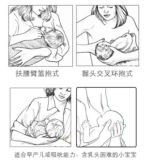 宝宝偏脖怎么纠正,宝宝吃偏奶怎么能纠正过来