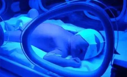 小儿黄疸十六点怎么治,小儿黄疸的原因中医