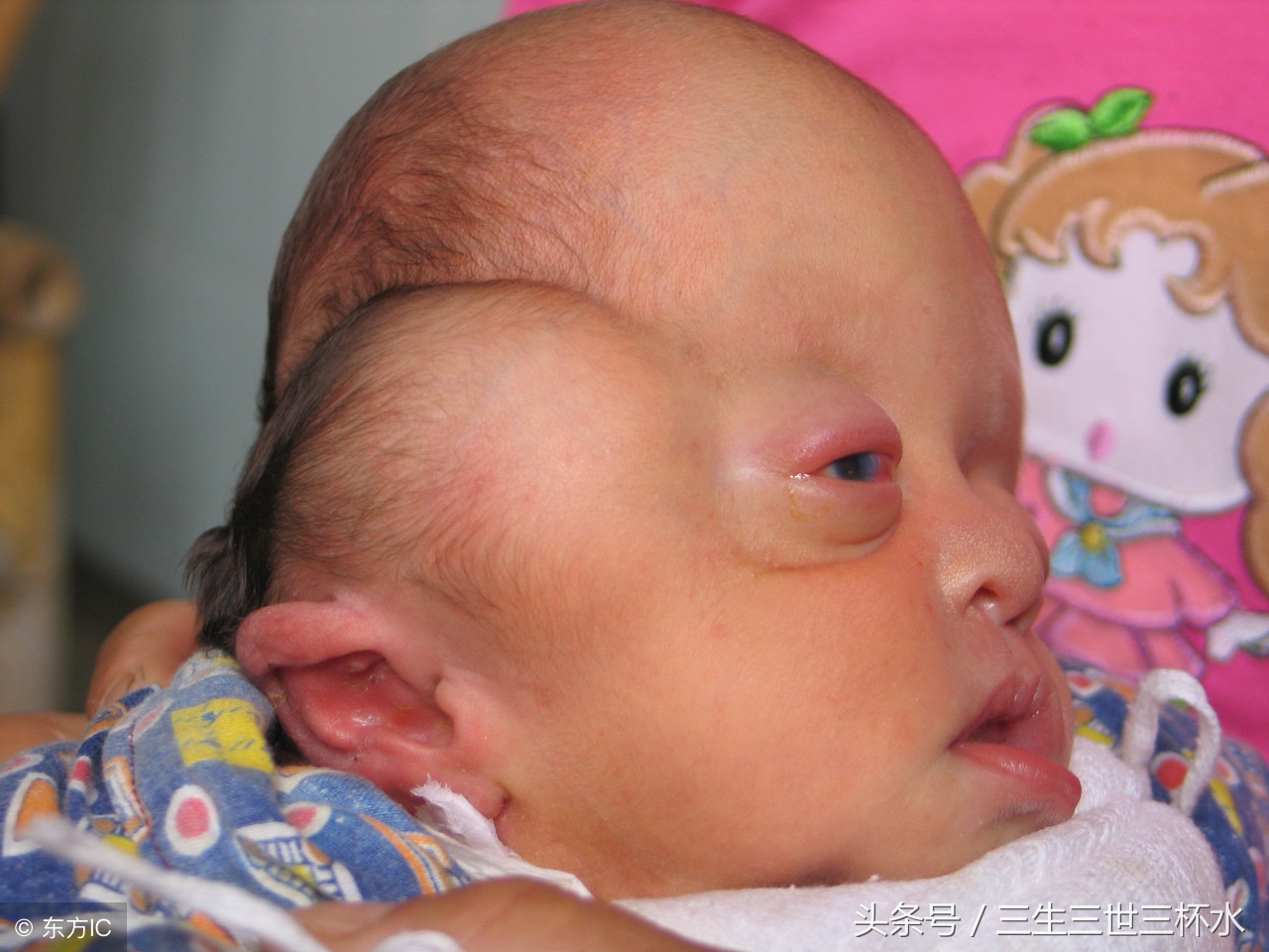 唐筛18临界风险有必要做无创dna吗,孕妈妈唐筛结果正常