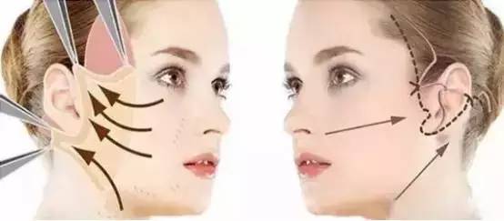 线雕是埋在哪个层次的,线雕埋进去能取出来吗