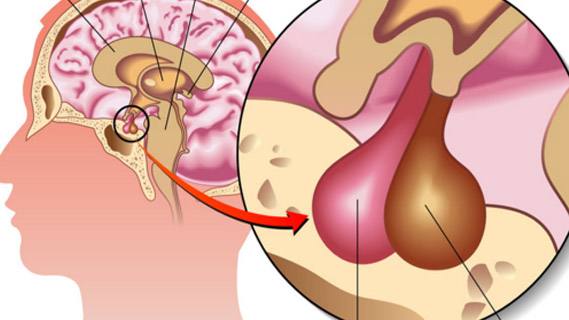 哺乳期妈妈的心理疏导,哺乳期情绪会影响奶水么