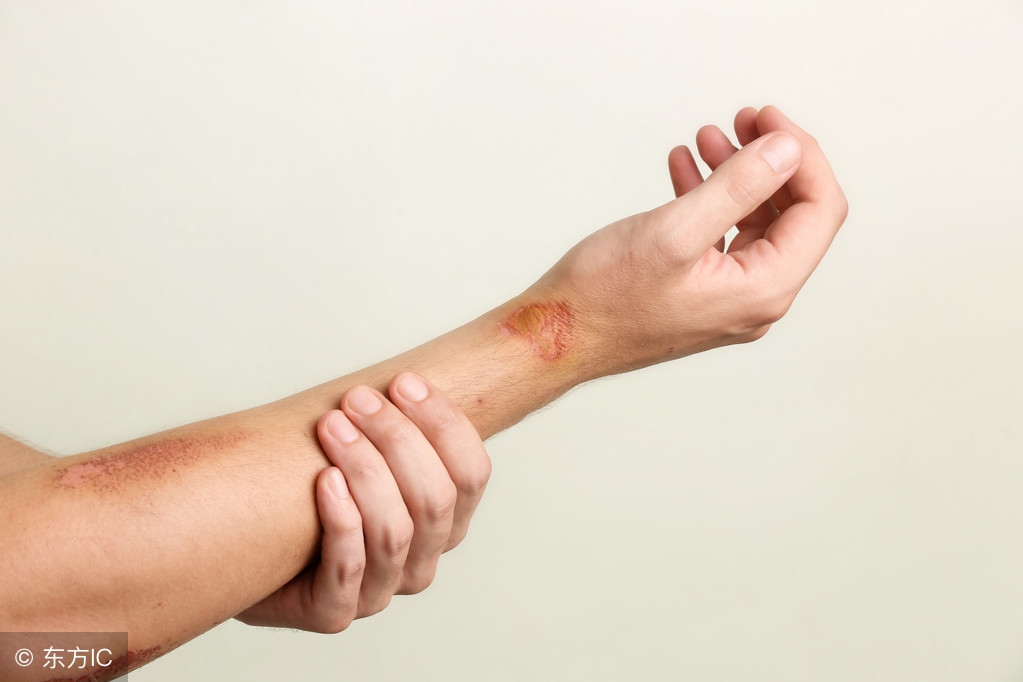 小刀划破手指要打碎伤风吗,手被小刀划破了不停的流血怎么办