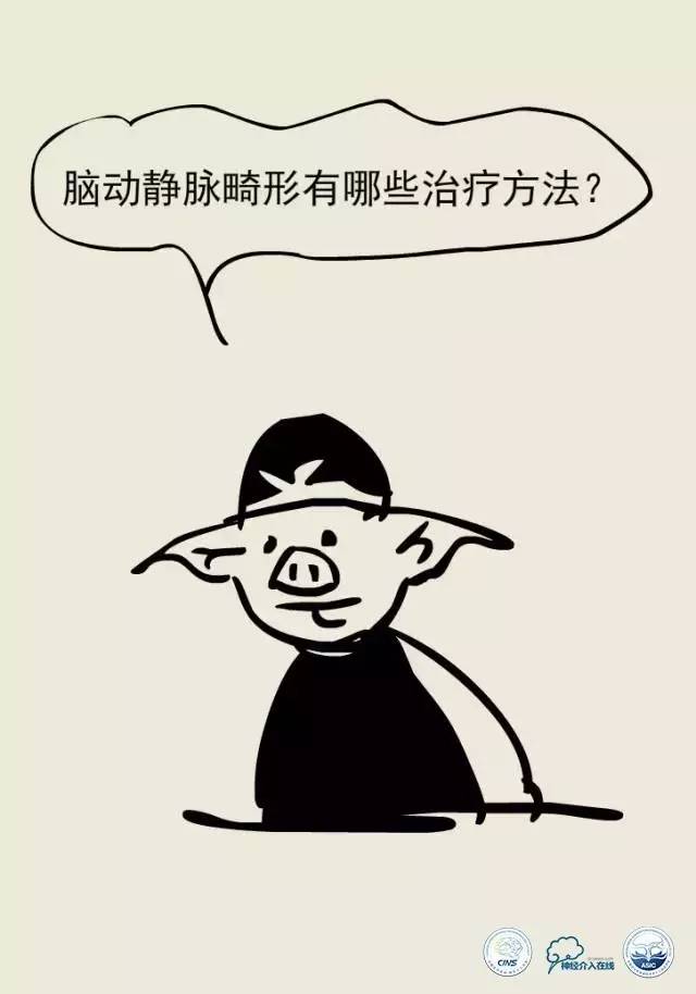 熊猫医生阿缪：脑动静脉畸形怎么破