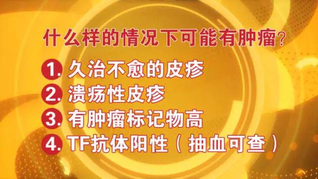 中日医院王国春教授,北京中日友好医院免疫科王国春