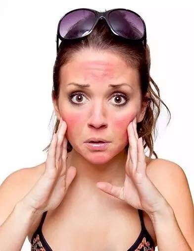 日本防晒和晒后修复,晒后修护全攻略不红不黑三步拿捏