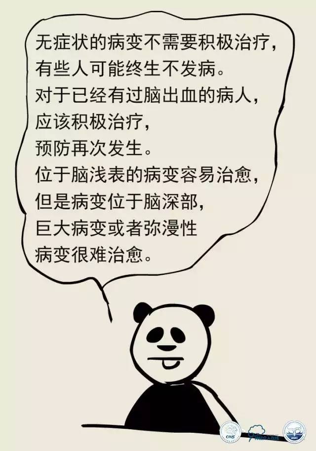 熊猫医生阿缪：脑动静脉畸形怎么破