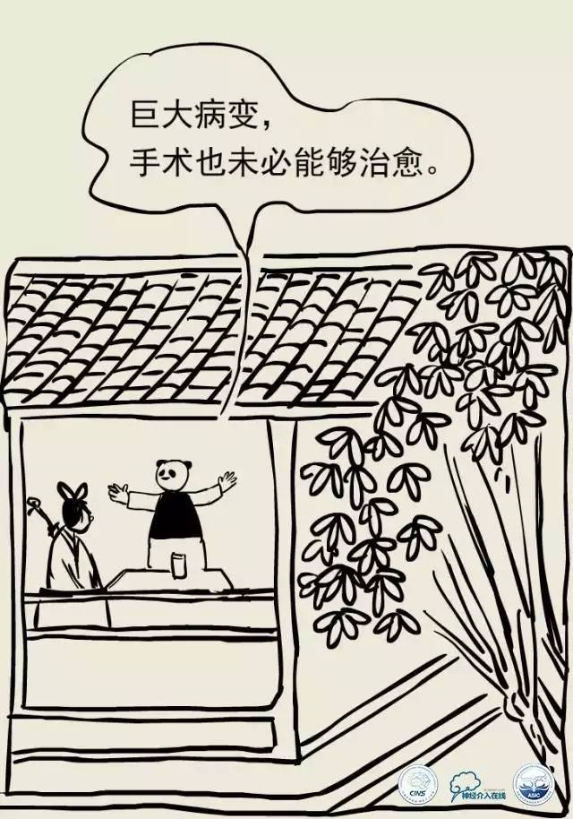 熊猫医生阿缪：脑动静脉畸形怎么破