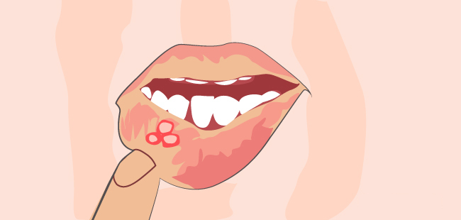 狗舔另外一只狗的嘴,被狗舔嘴有什么危害吗