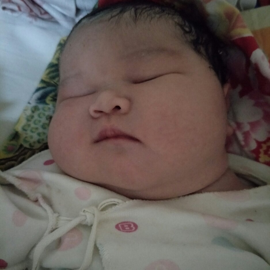 准妈妈们需警惕妊娠糖尿病,妊娠糖尿病孕妈