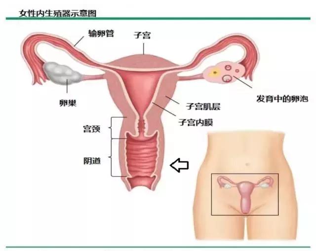 宫颈癌发病上升但可防可治,远离宫颈癌侵袭的妙招有哪些